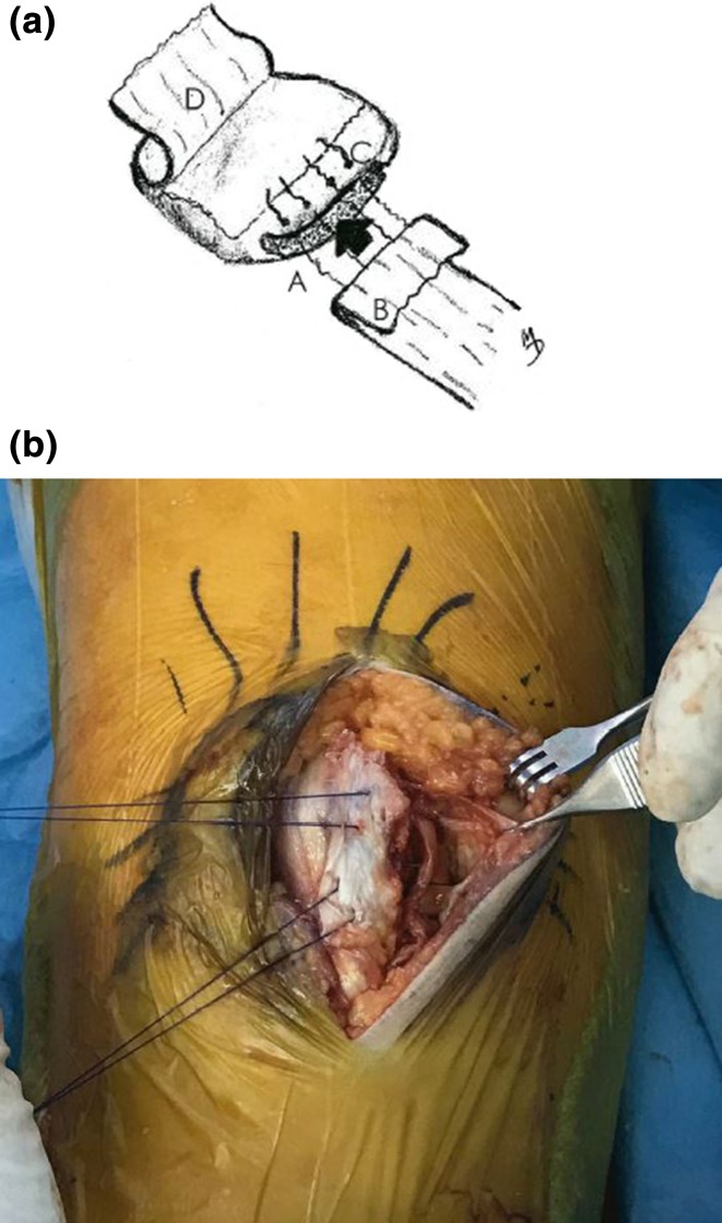 Fig. 4