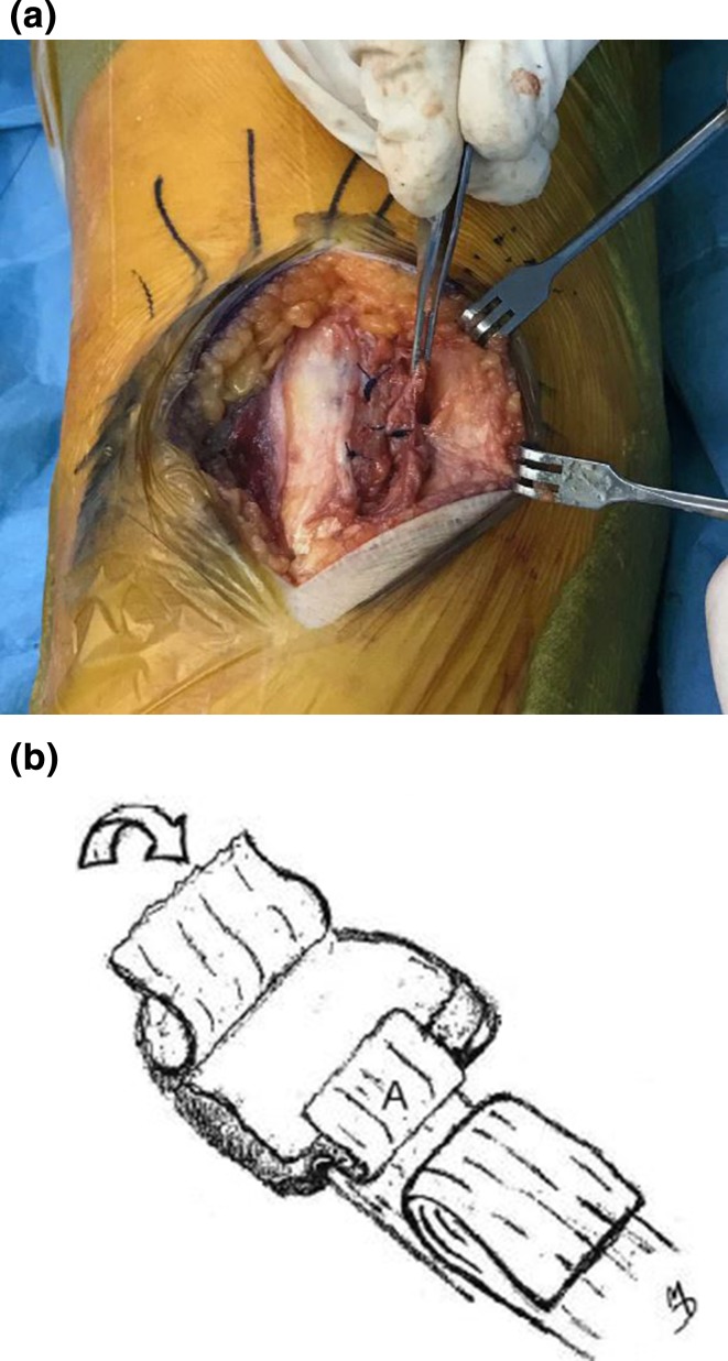 Fig. 6