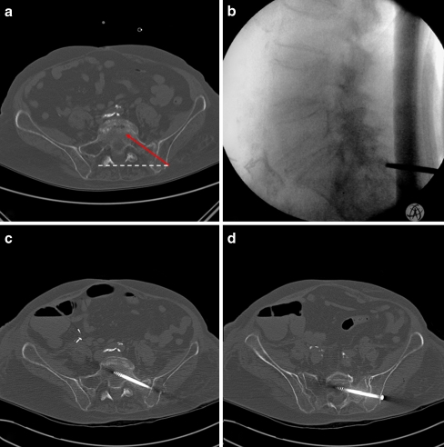 Fig. 2