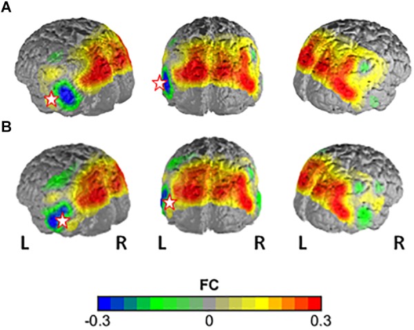 FIGURE 3