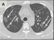 Figure 1a: