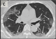 Figure 1c: