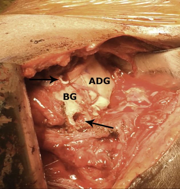 Fig 5