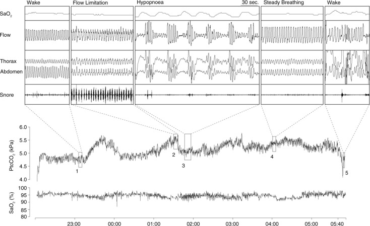 Fig. 1