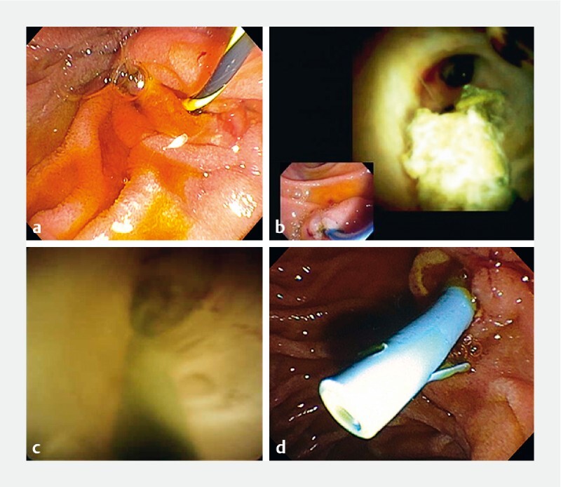 Fig. 1 