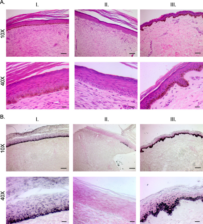 Fig 11