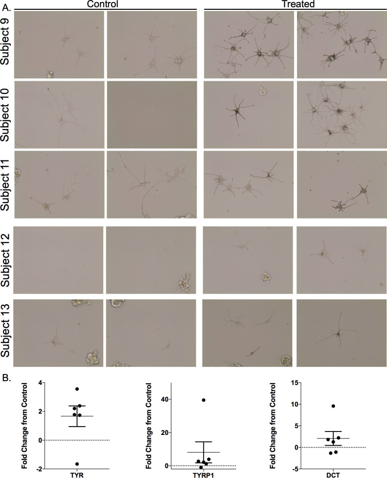 Fig 14