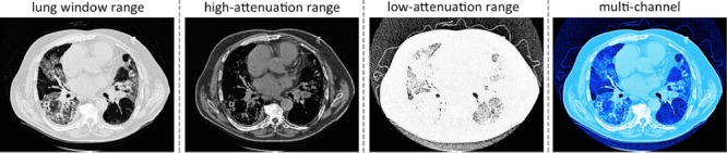 Fig. 4.