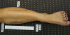 Fig. 2