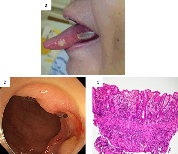 Fig. 2