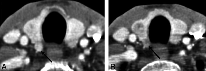 Fig 9.