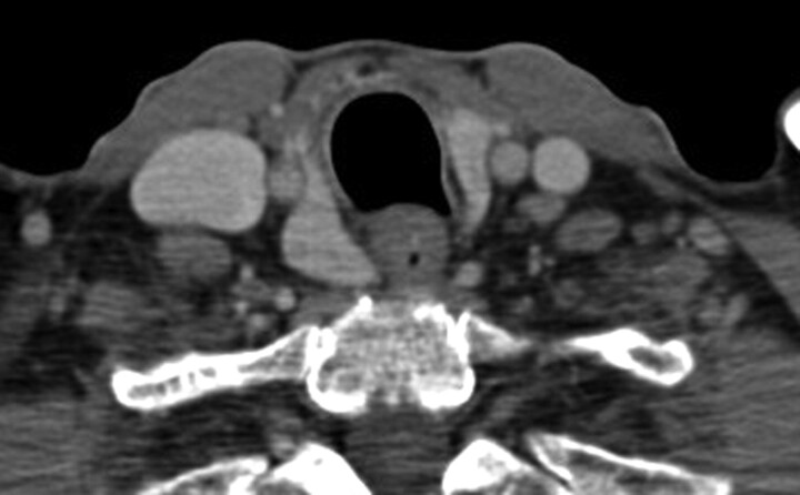 Fig 8.