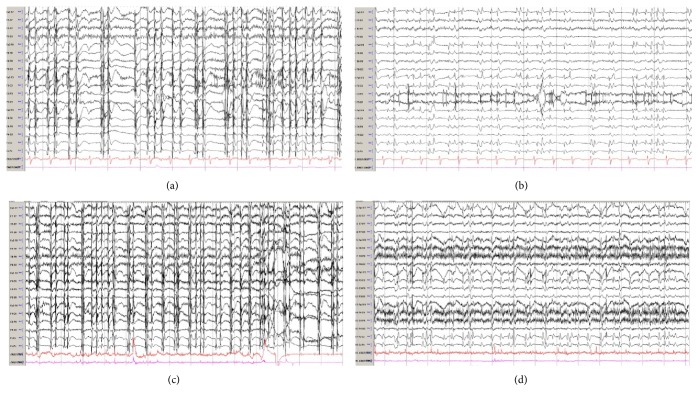 Figure 4