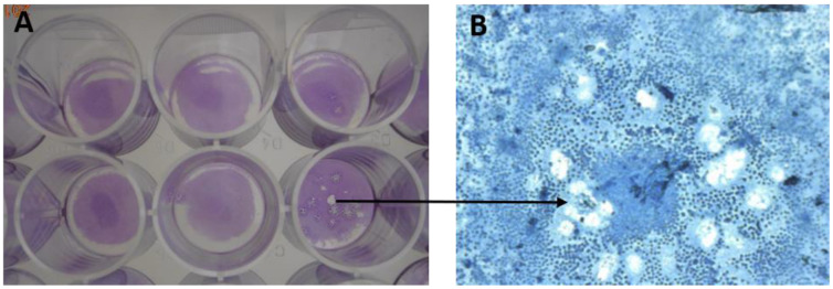 Figure 11