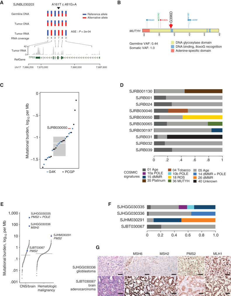 Figure 6. Evaluation of germline and tumor data to establish disease relevance. A, P53 A161T is a weakly functional likely pathogenic p53 variant in SJNBL030203. Six markers, including the germline variant C>T at chr17:7578449 (demarked by upside down triangle), are represented by three rows of vertical bars. The bars are colored red and blue to show the allele fractions in WGS data. The rows indicating germline and tumor DNA show most positions as heterozygous, with both red and blue portions. In the RNA, all markers are monocolored, indicating that only one allele is expressed. At the location of the germline variant (C>T), the bar is completely red, indicating that only the variant allele is expressed, suggesting that the wild-type allele is transcriptionally silenced. ASE, allele-specific expression. B, A pathogenic MUTYH germline founder mutation, G396D, in retinoblastoma patient SHRB030050. C, The TMB for SHRB030050, from WGS data, is in the upper quartile compared with other retinoblastoma patients, including those from St. Jude Cloud. Box includes the second to third quartiles; horizontal bar within box is median. D, Mutation signatures from WGS data from retinoblastoma patients available in G4K and from the PCGP in the St. Jude Cloud resource (https://www.stjude.cloud/). Sixty percent of tumor mutations in SHRB030050 are attributable to damage by ROS. E, TMB plots of brain and hematologic tumors. The three tumors that are hypermutated (those with >10 mutations/Mb) are labeled with patient ID and the genes that were mutated to cause hypermutation. A fourth brain tumor with a TMB close to median was heterozygous for mutation of PMS2. The two hypermutated patients with PMS2 carried compound heterozygous mutation of the gene. The patient with the highest TMB also carried an S459F mutation of POLE. F, Mutation signatures of the patients in E. G, IHC staining for the indicated MMR proteins in the brain tumors of patients SJHGG030336 and SJBT030067. Top, infiltrative astrocytoma with severe cytologic atypia, mitotic activity, and necrosis, diagnostic of glioblastoma. IHC for MMR proteins exhibited loss of MSH2 and MSH6 but retained staining in stromal elements. Bottom, gastrointestinal-type adenocarcinoma arising in malignant mixed germ cell tumor. Staining for MMR proteins demonstrated retained expression of MSH2, MSH6, PMS2, and MLH1. All images are 40× magnification; scale bars, 40 μm.