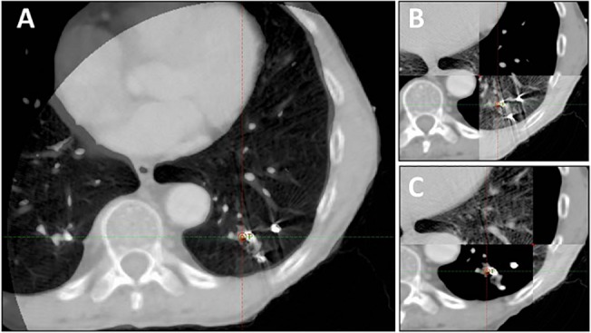 Fig 3