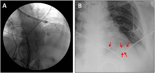 Fig 2