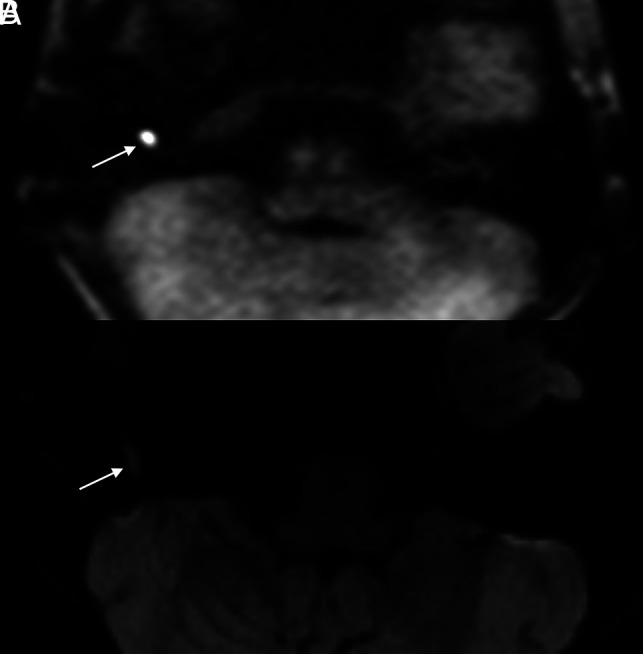 FIG 2.