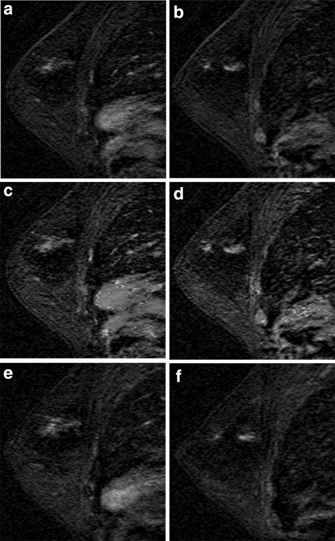 Fig. 12