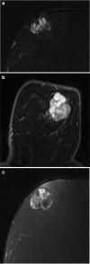 Fig. 9