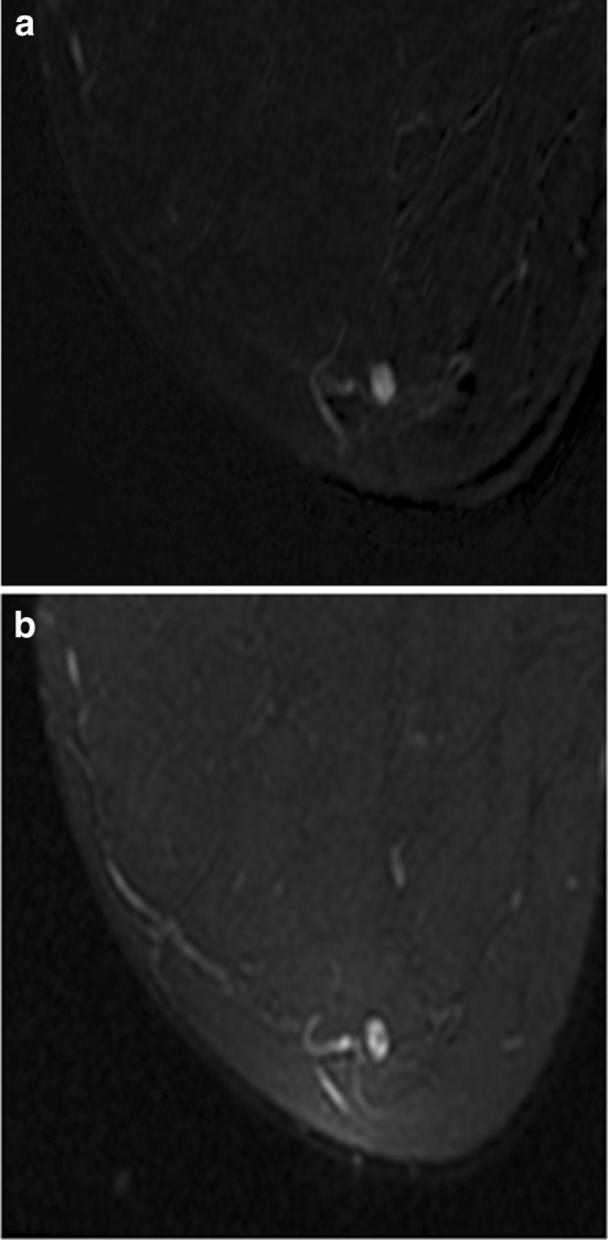 Fig. 10