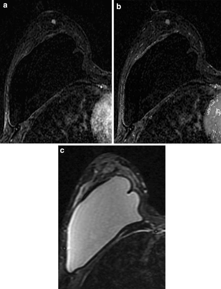 Fig. 11