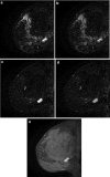 Fig. 13