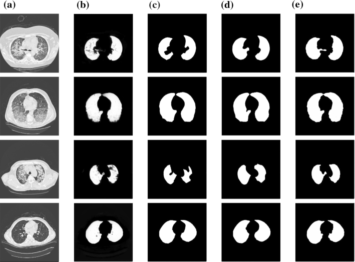 Fig. 15