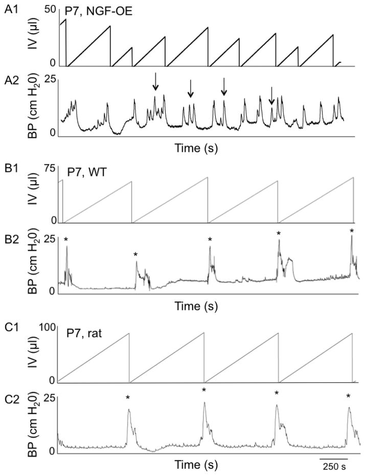 Figure 11