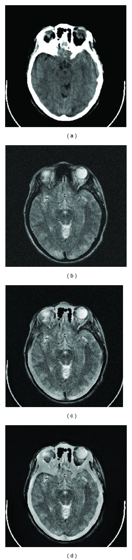 Figure 4