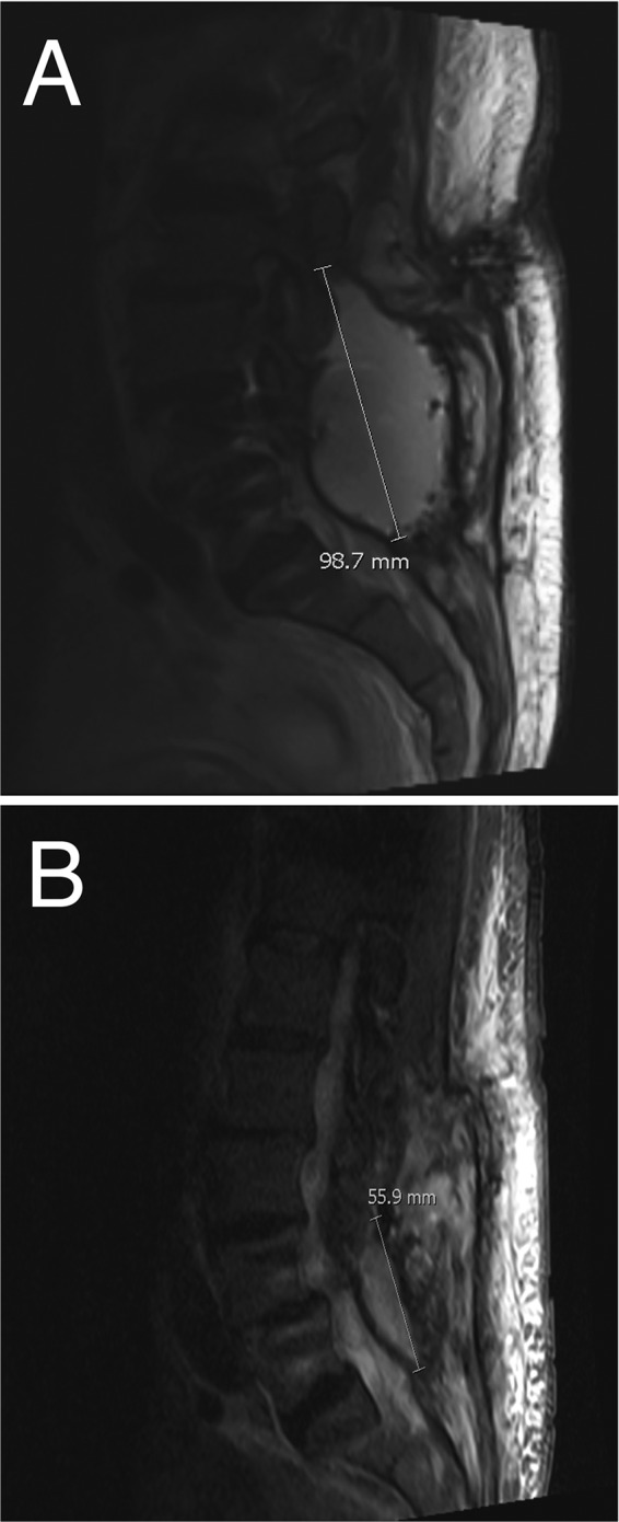 FIG 1