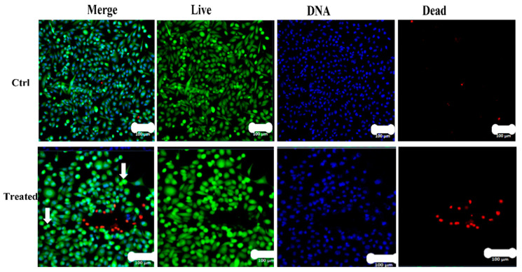 Figure 12