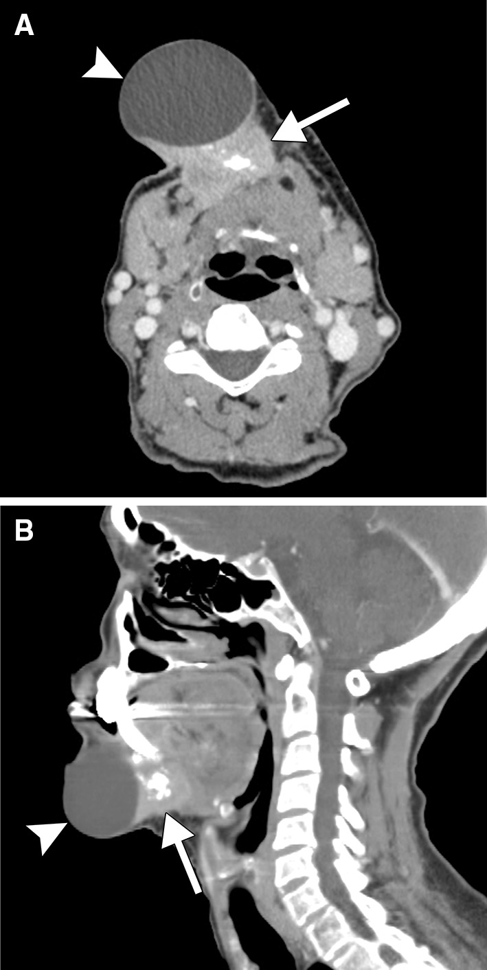 Fig. 1