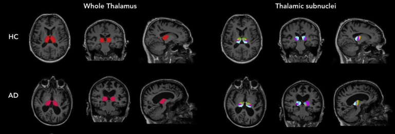 Fig. 1