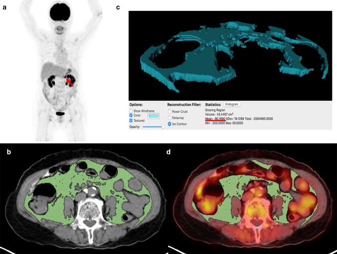 Fig. 1