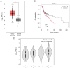 Figure 1. UBE2T correlates with poor prognosis and progression of HNSCC. (A) Analysis of UBE2T expression in HNSCC tumor (Tumor; red) and normal tissues (Normal; gray) using GEPIA web server. Values r...
