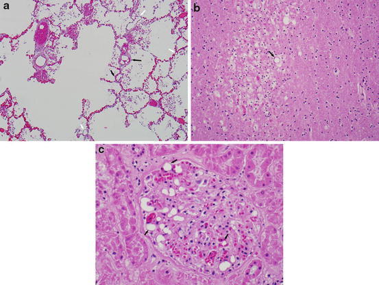 Fig. 30.13