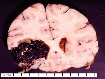 Fig. 30.3