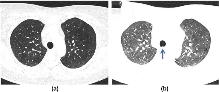 Figure 15