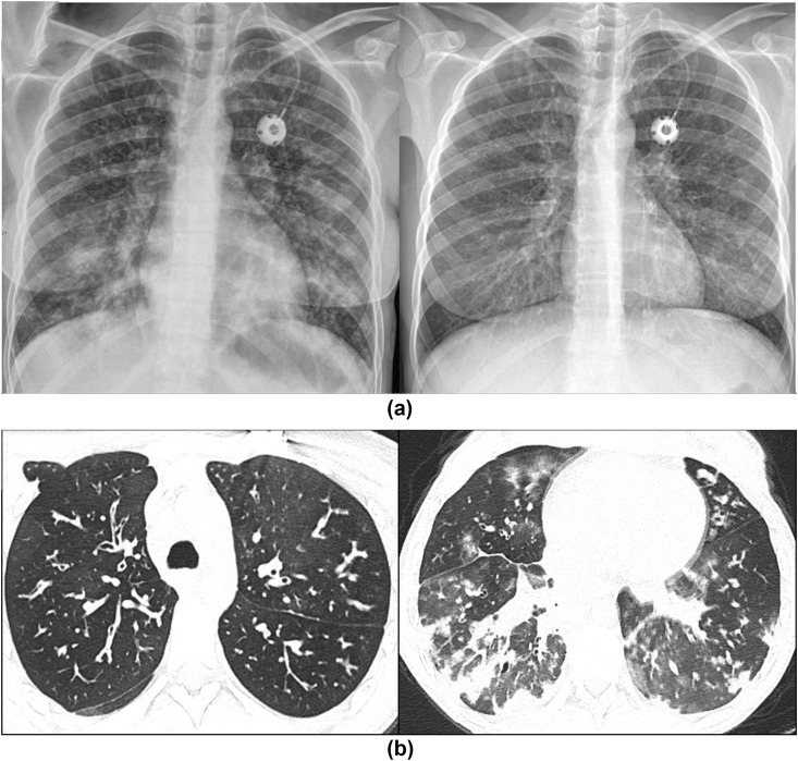 Figure 4