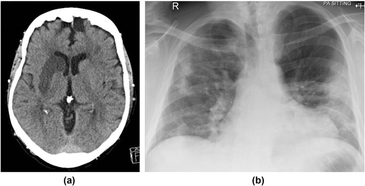 Figure 13