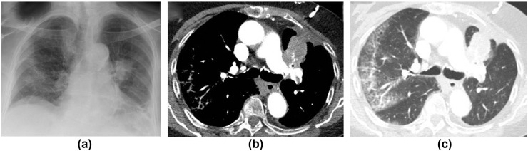 Figure 18