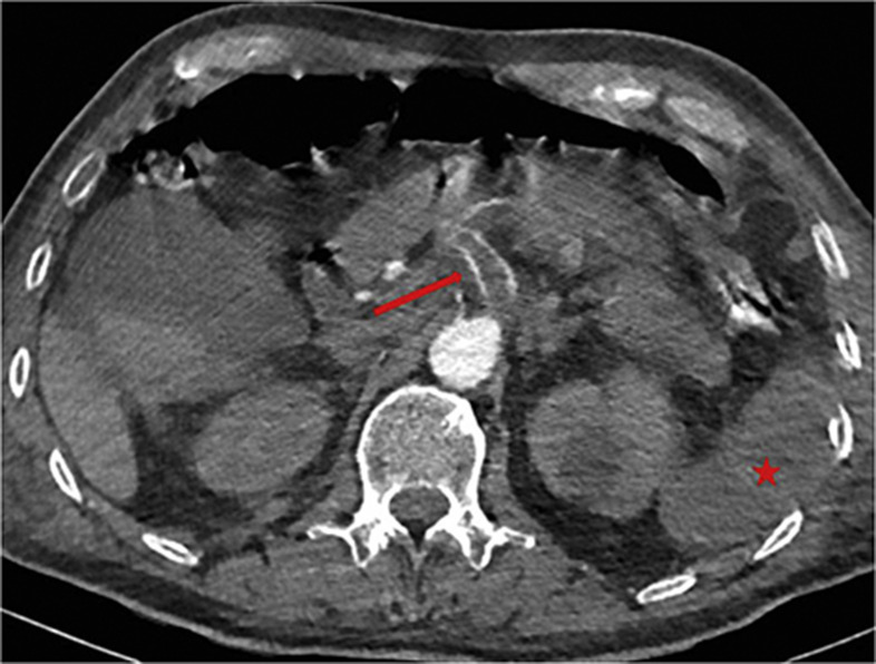 Figure 1