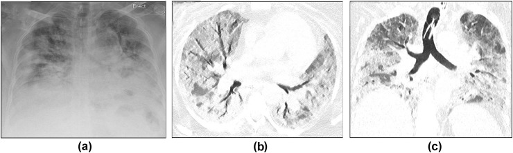 Figure 2