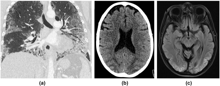 Figure 14