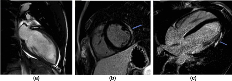 Figure 12