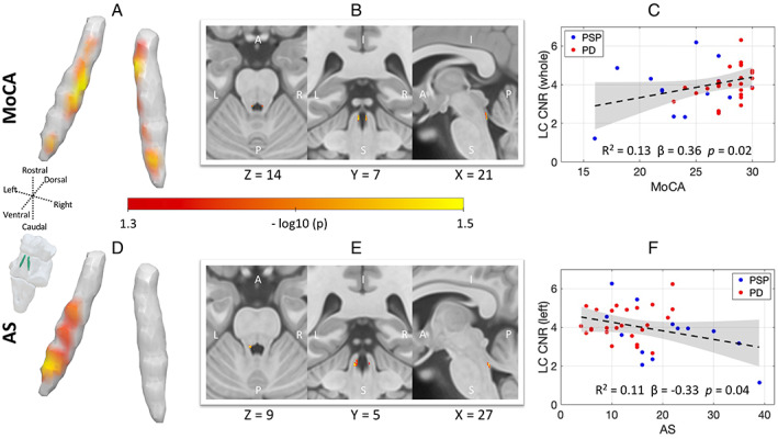 FIG 2