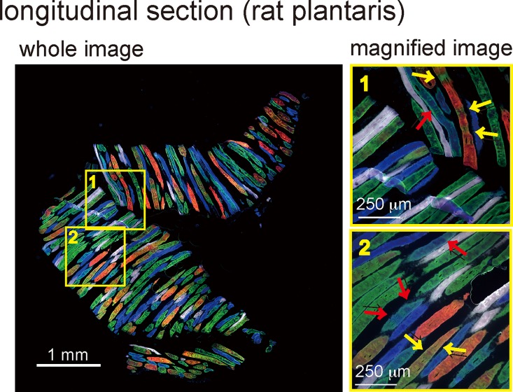 A One-Step Immunostaining Method to Visualize Rodent Muscle Fiber Type ...