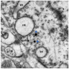 Fig. 11