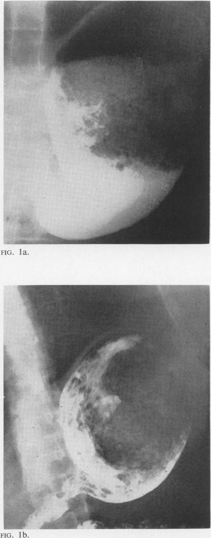 FIG. 1a-1b